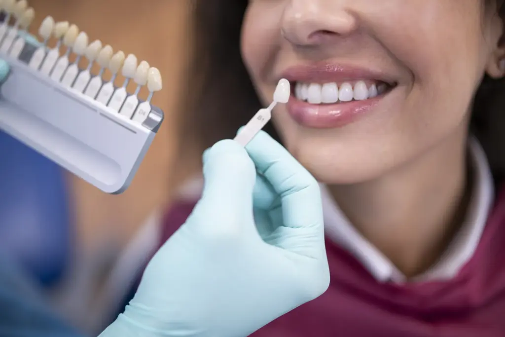 A dentist holding a tooth shade guide against a patient's teeth to match a crown